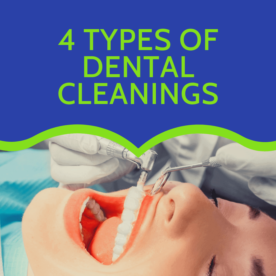 4 Types Of Dental Cleanings Laurich Dentistry